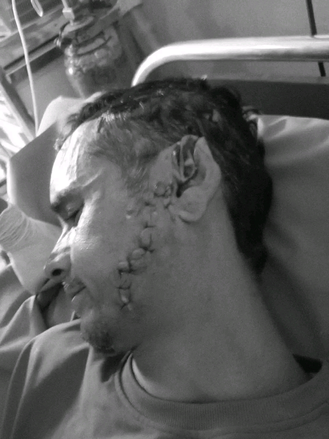  बझाङमा शिक्षकमाथि धारिलो हतियार प्रहार