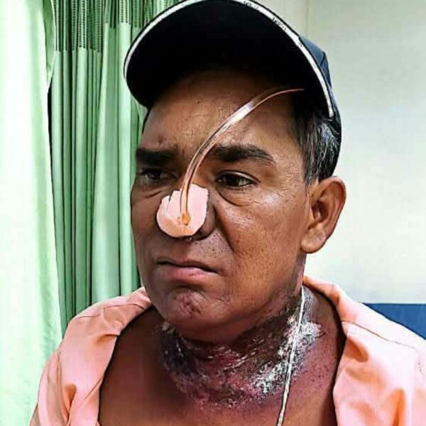 घाँटीको क्यान्सरबाट पीडित पुर्चौडीका गडालको आर्थिक अभावले उपचारमा समस्या